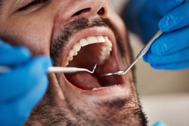 Best Broken or Cracked Tooth Emergency Dentist in Chattahoochee Hills, GA