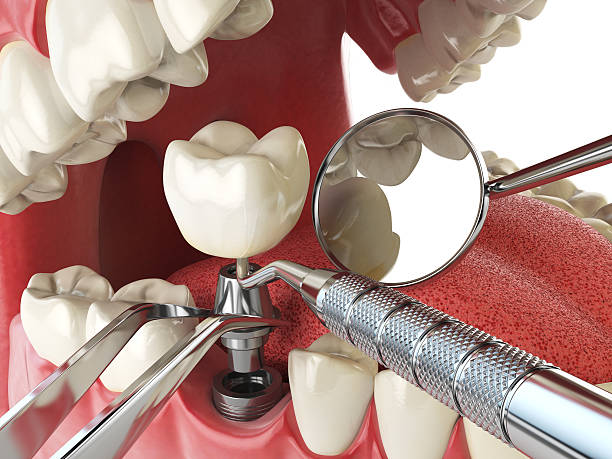 Best Orthodontic Emergency Dentist in Chattahoochee Hills, GA